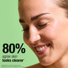 80% agree skin looks clearer*
*Independent User Trial of the Salicylic Acid Exfoliating Toner with 52 participants after 28 days
