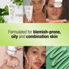 Formulated for blemish prone oily and combination skin