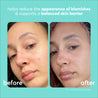 Before and after image of woman using the Clear Skin range for 4 weeks, with reduces appearance of blemishes.