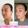 Before and after comparisons showing a more even, smooth texture skin in the after.